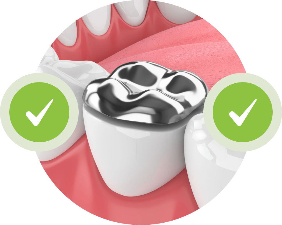 Tooth Fillings Treatment in Mississauga, ON